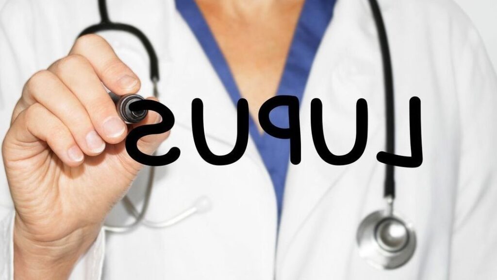 Lupus et Chute de Cheveux : Comprendre et Gérer cette Manifestation Courante