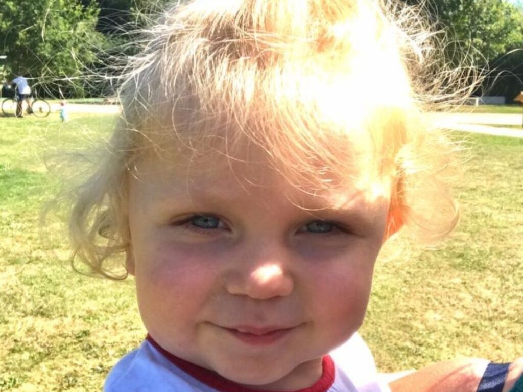 Purpura chez les enfants : peut-on incriminer les tomates dans son apparition ?