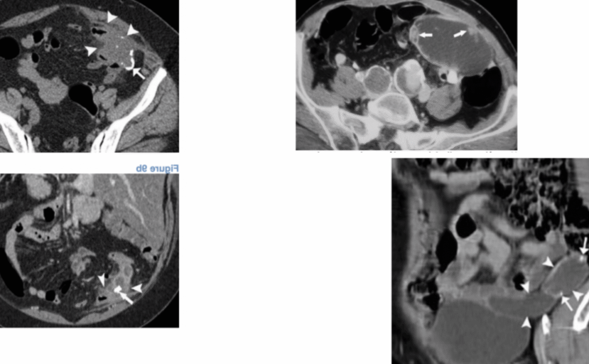 À la découverte du scanner abdomino-pelvien à Bordeaux : Votre guide complet pour un diagnostic précis