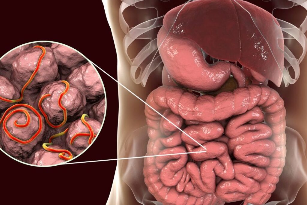 Comment se débarrasser des oxyures avec des remèdes de grand-mère ?