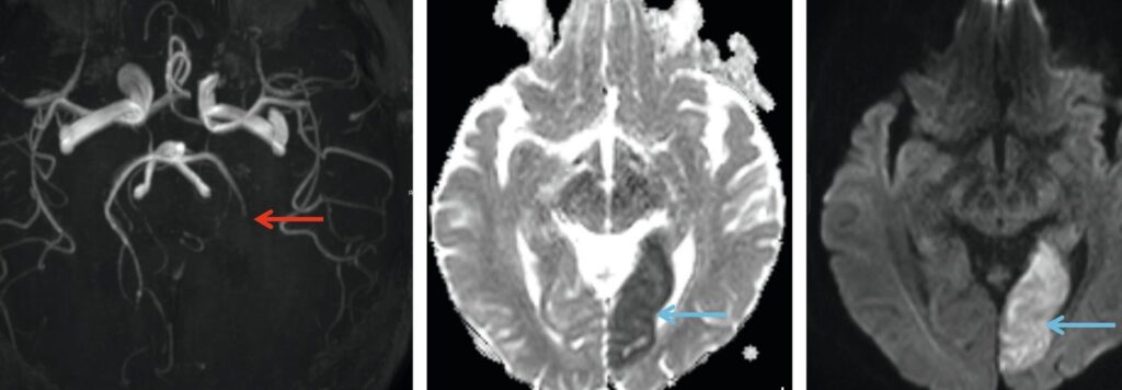 Scanner cérébral avec injection de contraste : Quels sont les avantages et quand est-il nécessaire ?