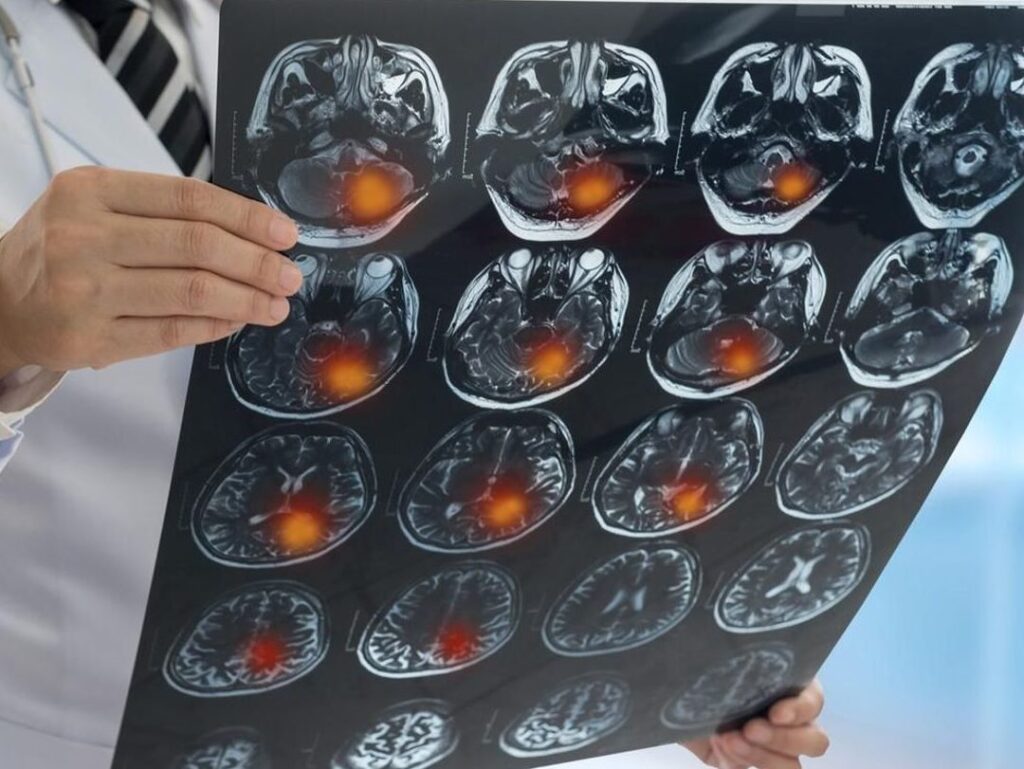 Les signaux d&rsquo;alerte : reconnaître les signes d&rsquo;un avortement incomplet