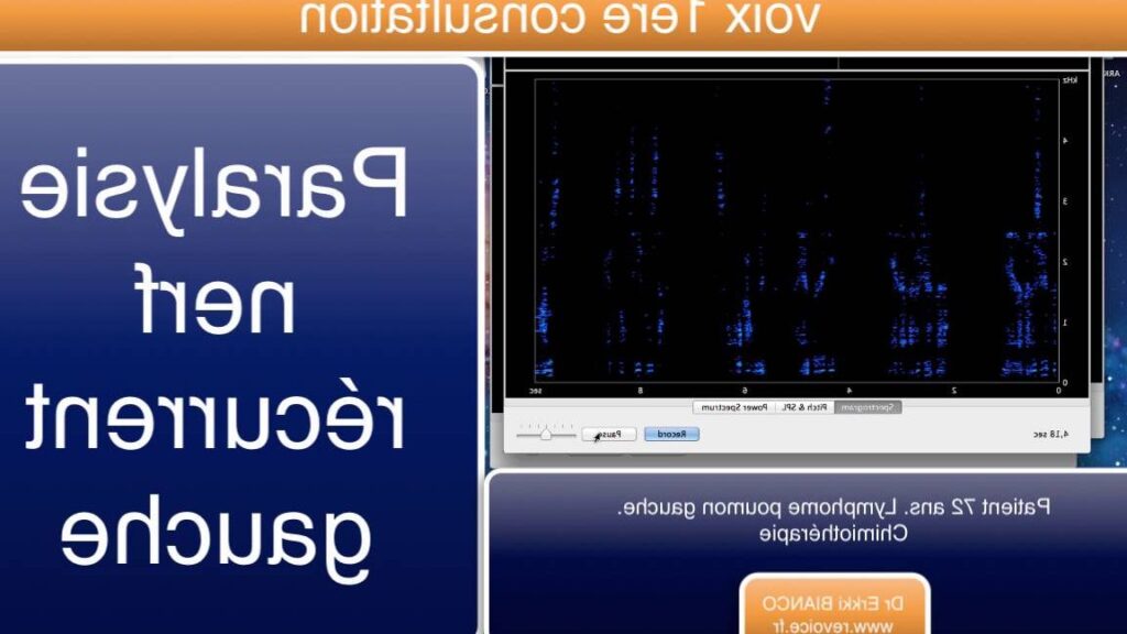 Trouver le bon phoniatre à Nantes : Conseils et adresses incontournables