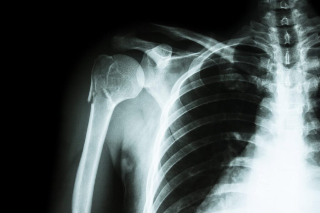 Absence d&rsquo;anomalie des parties molles : Comprendre les résultats de votre examen d&rsquo;imagerie